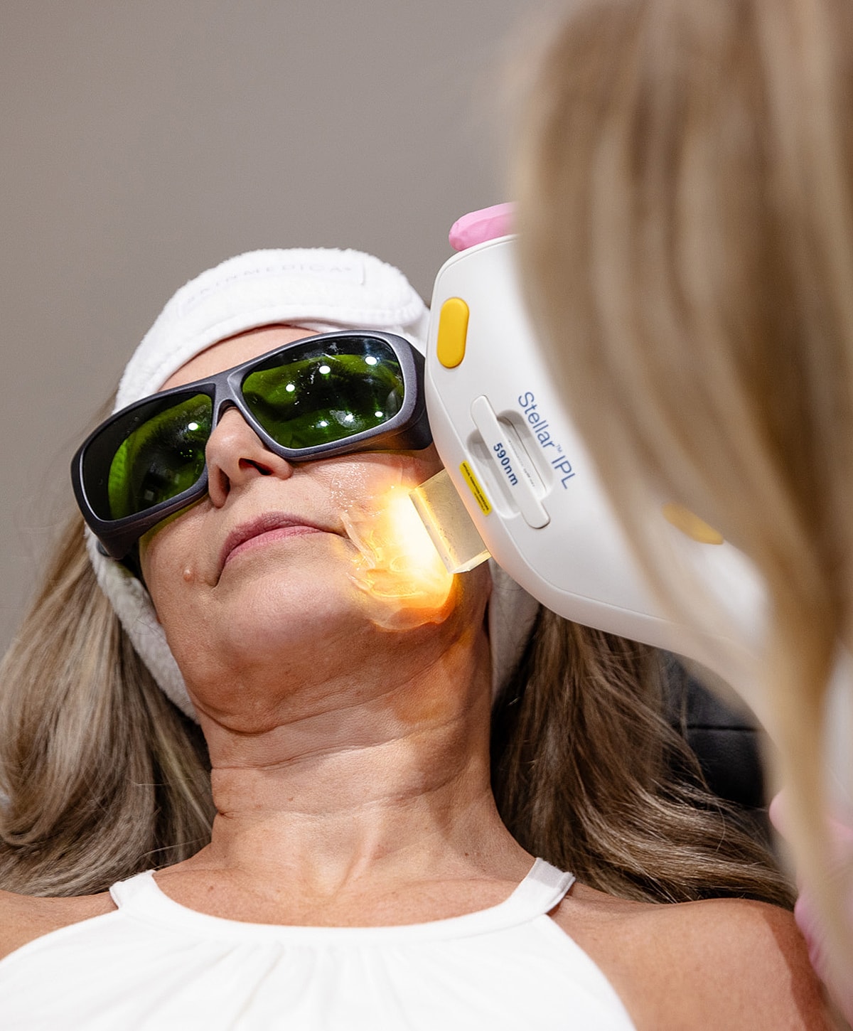 Woman receiving IPL skin treatment procedure.