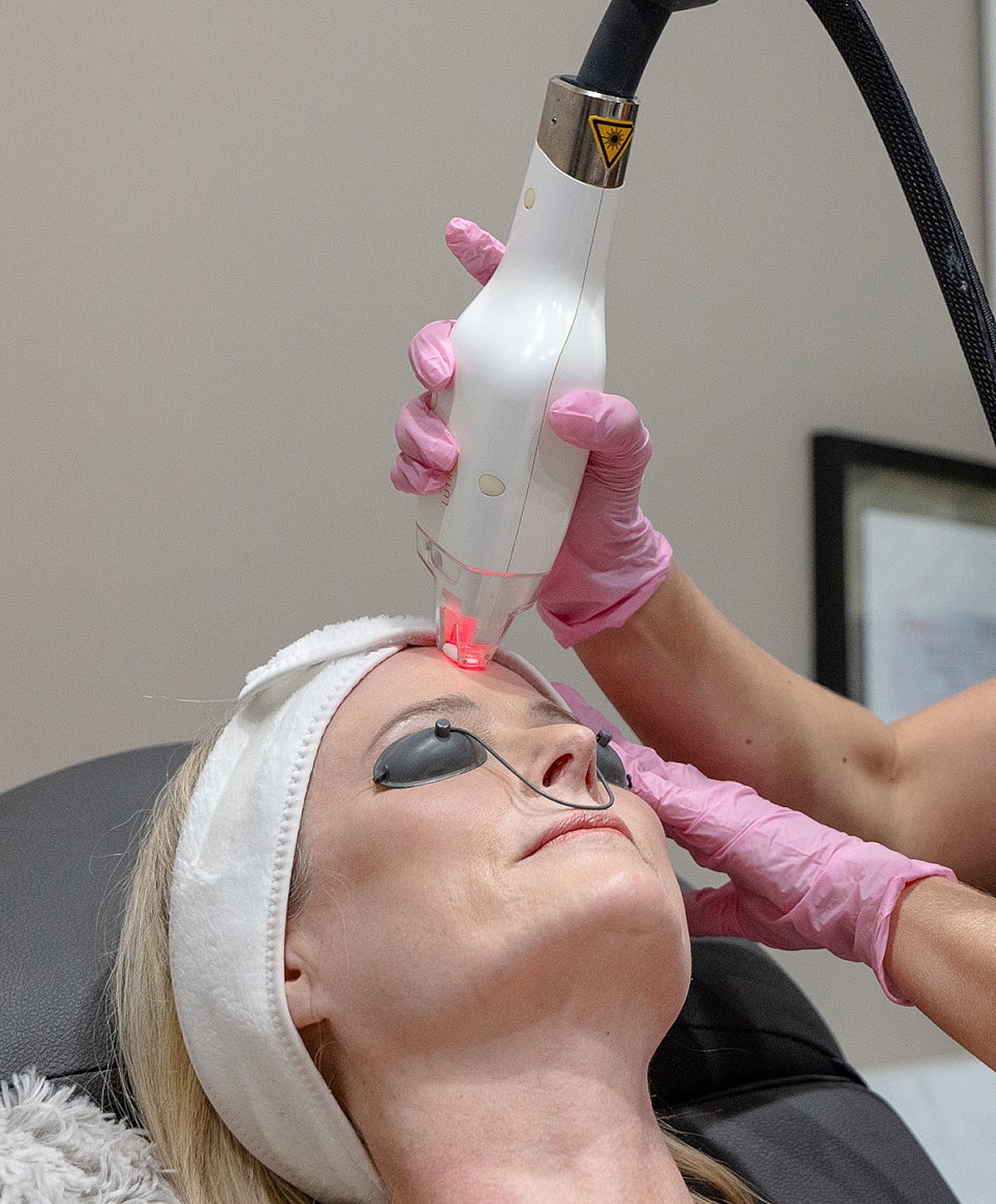 Laser treatment being applied to a woman's face.